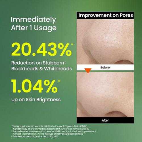 Mung Bean Pore Detox Trio [Bundle]