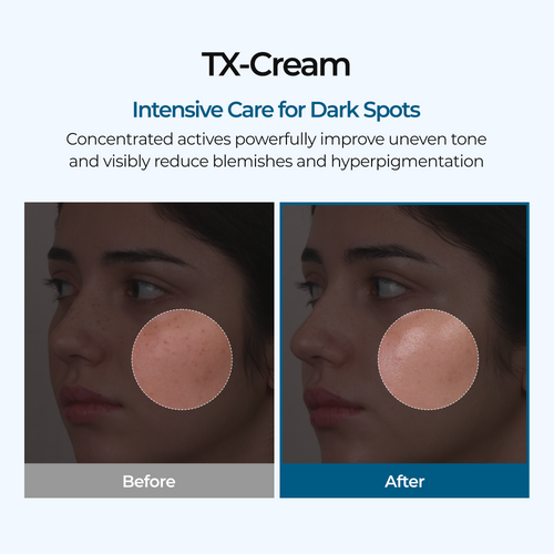 TX Cream - Dark Spot Corrector