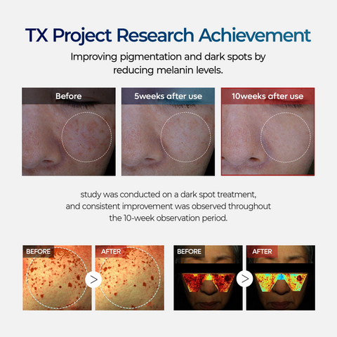 TX Cream - Dark Spot Corrector