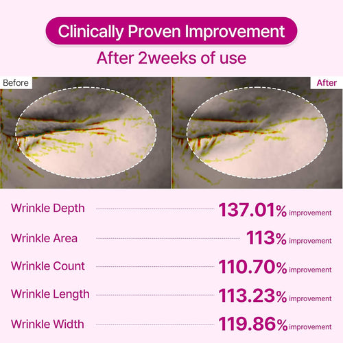 Calcium Multi Balm - Wrinkles, Dark Spots, Sagging