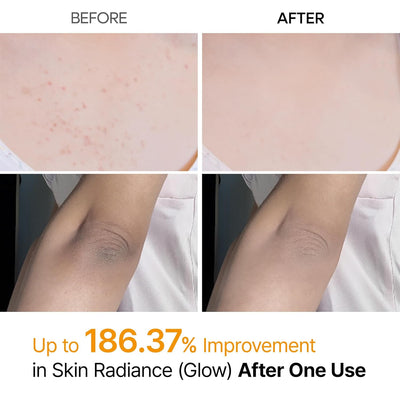 Kojic Acid Turmeric Body Spray