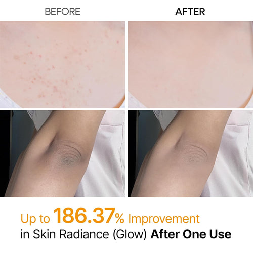 Kojic Acid Turmeric Body Spray