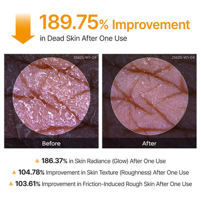 Kojic Acid Turmeric Body Spray