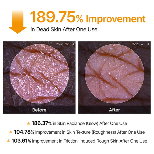 Kojic Acid Turmeric Body Spray
