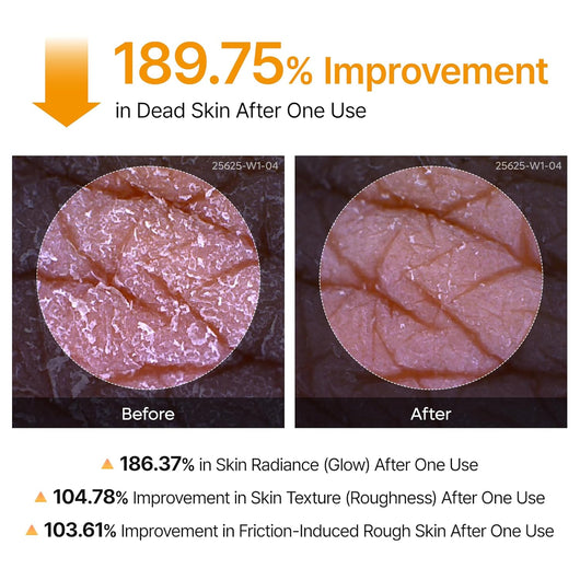 Kojic Acid Turmeric Body Spray