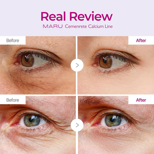 Calcium Multi Balm - Wrinkles, Dark Spots, Sagging